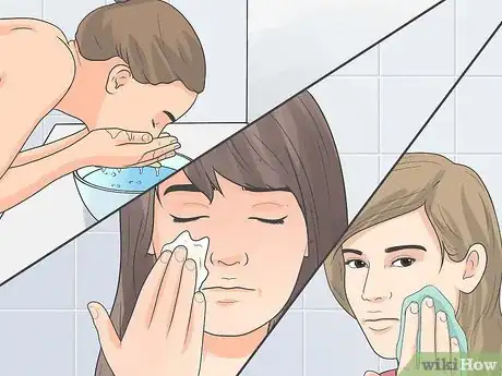 Image titled Treat Cystic Acne Naturally Step 5