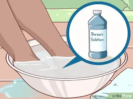 Image titled Dry Up Poison Ivy Rash Step 3