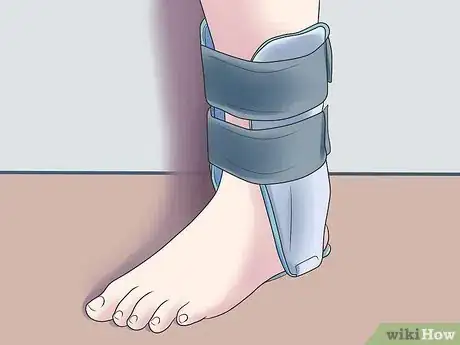 Image titled Treat a Broken Ankle Step 7