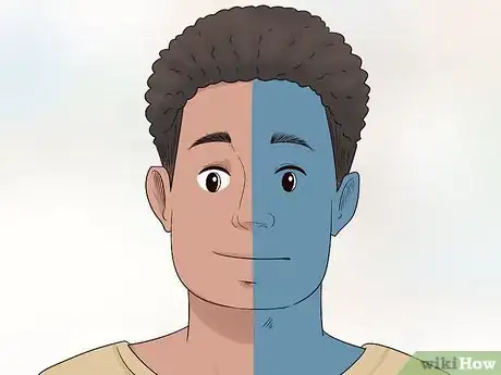 Image titled Diagnose Bell's Palsy Step 2