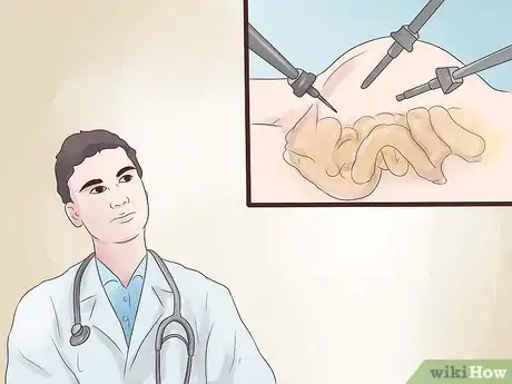 Image titled Treat Blocked Fallopian Tubes Step 15