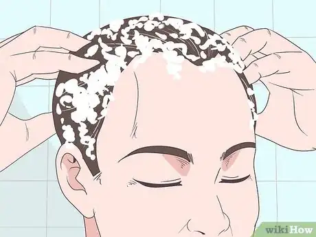 Image titled Make Your Hairline Grow Back Step 3