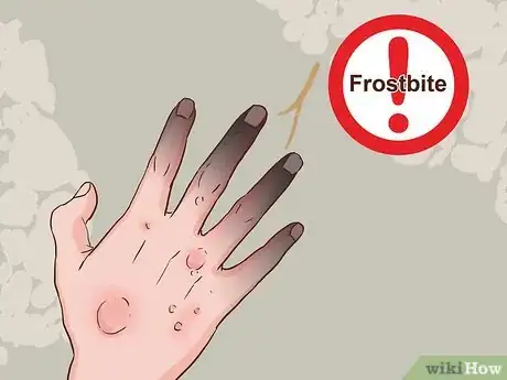 Image titled Prepare for Winter Camping Step 27