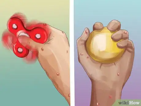 Image titled Stop Dermatillomania Step 14