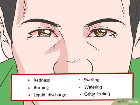 Image titled Comfort a Sore and Itchy Eye Step 8