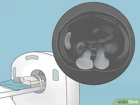 Image titled Test for Kidney Disease Step 9