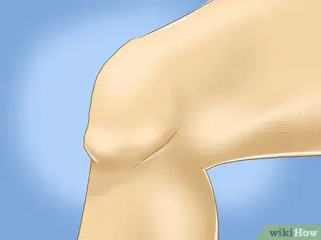 Image titled Get Rid of Knee Pain from Running Step 1
