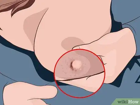 Image titled Avoid Sore Nipples While Breast Feeding Step 16