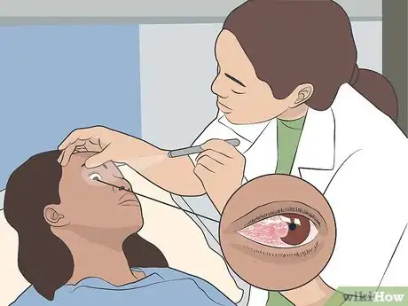 Image titled Treat Pinpoint Pupils Step 4