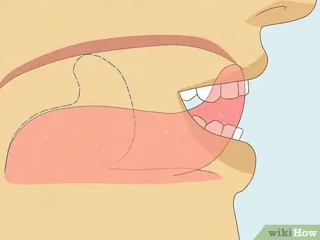 Image titled Gleek Step 9