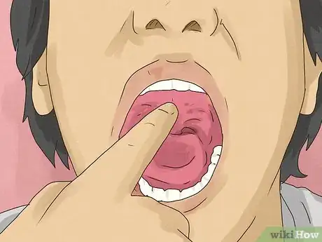 Image titled Force a Burp Step 5