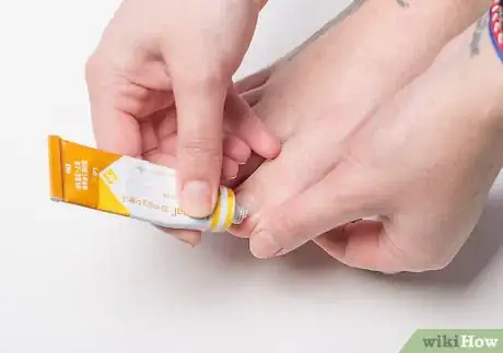Image titled Soak an Ingrown Toenail Step 5