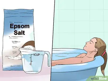 Image titled Get Rid of Muscle Cramps with Minerals Step 7