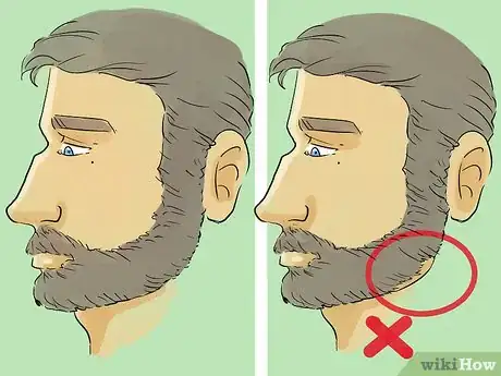 Image titled Maintain a Beard for a Professional Look Step 3