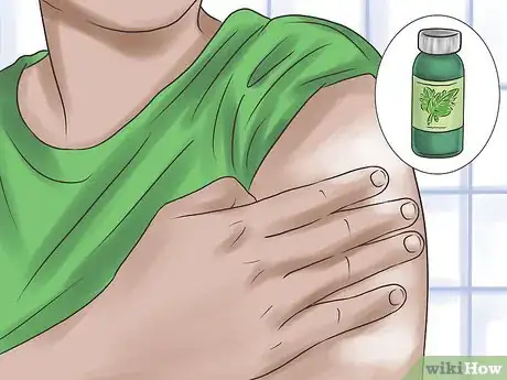 Image titled Care for Itchy and Irritated Skin Step 9