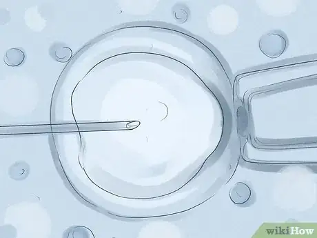 Image titled Treat Infertility Step 11
