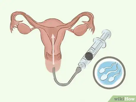Image titled Treat Infertility Step 10