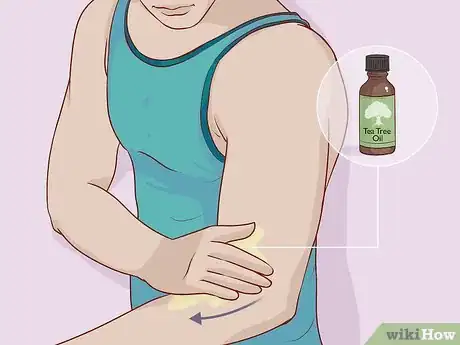 Image titled Treat Skin Conditions with Tea Tree Oil Step 8