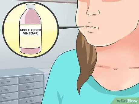Image titled Get Rid of a Tooth Infection Step 9