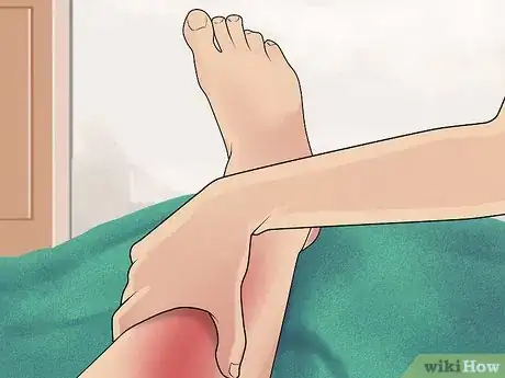 Image titled Prevent Shin Splints Step 12