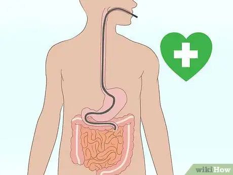 Image titled Diagnose Celiac Disease Step 7