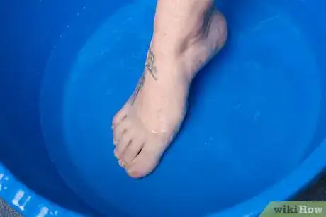 Image titled Soak an Ingrown Toenail Step 2