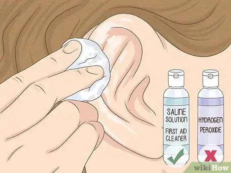 Image titled What Can You Use to Clean an Ear Piercing Step 3