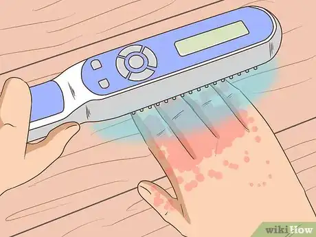 Image titled Achieve Psoriasis Remission Step 3