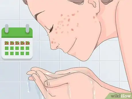 Image titled Get Clear Skin in 1 Week Step 5