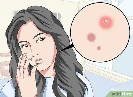 Image titled Treat Skin with Glycolic Acid Step 1