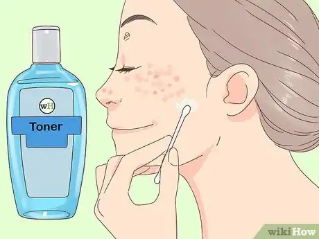 Image titled Get Clear Skin in 1 Week Step 4