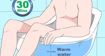 Know if You Have Epididymitis