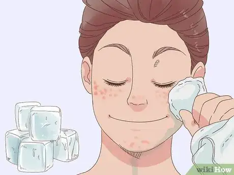 Image titled Get Clear Skin in 1 Week Step 9