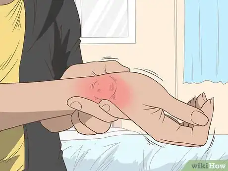 Image titled Identify Hyperuricemia Step 3