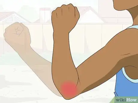 Image titled Diagnose Bursitis Step 9