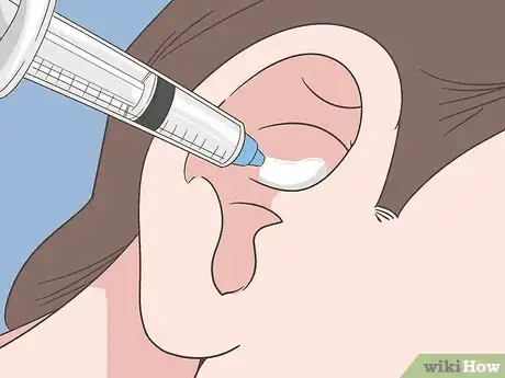 Image titled Prevent Cerumen Impaction Step 4