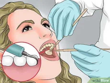 Image titled Prevent Plaque Step 18