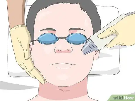 Image titled Cure Oily Skin Step 13