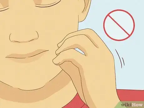 Image titled Clean Your Face to Prevent Pimples Step 26