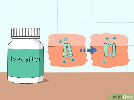 Image titled Treat Cystic Fibrosis Step 2