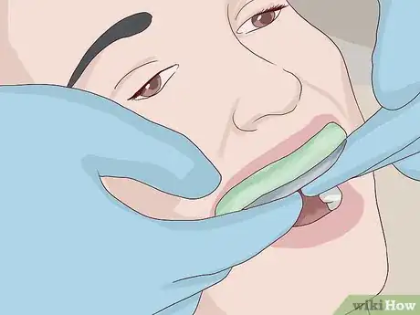 Image titled Know What to Expect when Getting a Tooth Implant Step 16