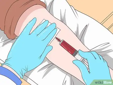 Image titled Know if You Have Epididymitis Step 14