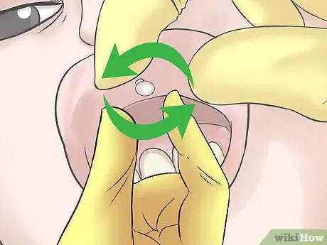 Image titled Take Out a Monroe Piercing Step 7