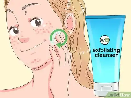 Image titled Get Clear Skin in 1 Week Step 3