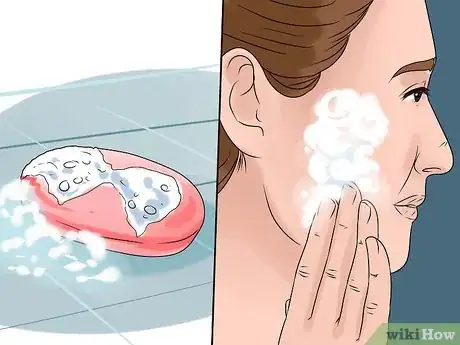 Image titled Treat Winter Eczema Step 15