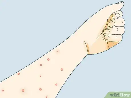 Image titled Prevent Flea Bites Step 19