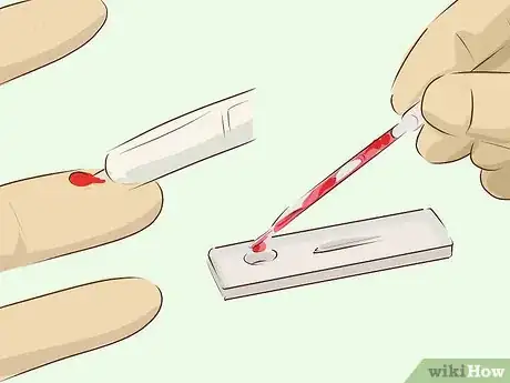 Image titled Get Tested for HIV Step 7