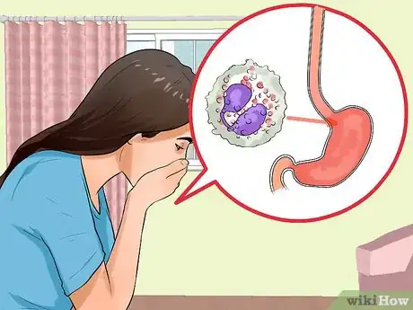 Image titled Know if You Have Esophagitis Step 3