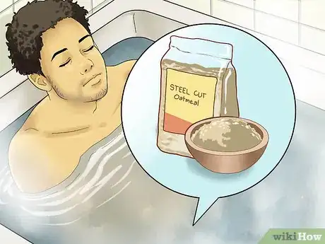 Image titled Dry Up Poison Ivy Rash Step 4