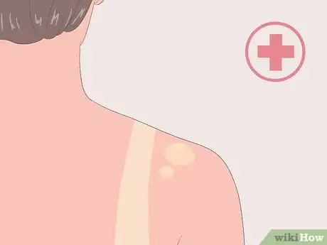 Image titled Get Fair Skin Naturally Step 14